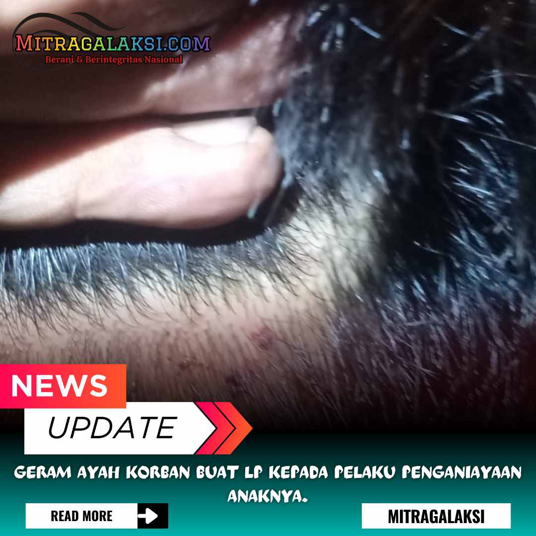 Geram Ayah Korban Buat LP Kepada Pelaku Penganiayaan Anaknya.